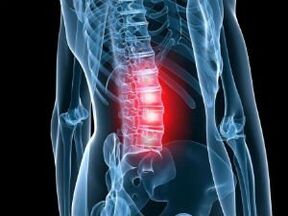 Bones and cartilage of the lumbar spine