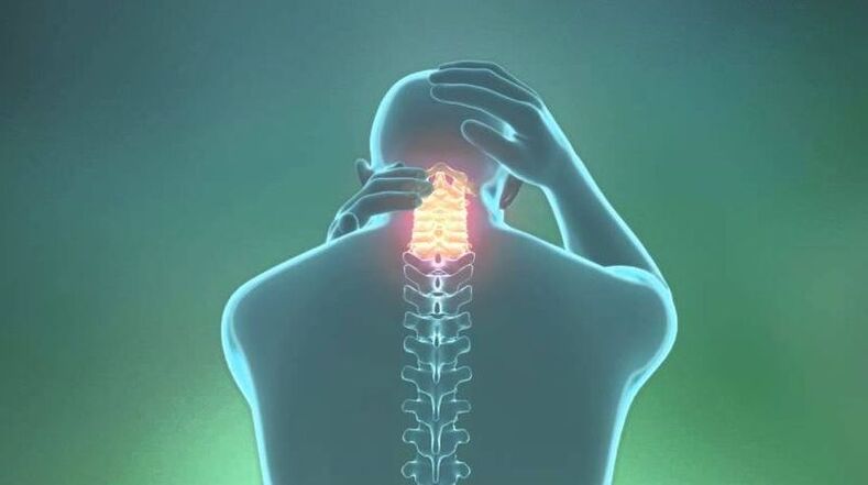 Osteochondral disease in the cervical area