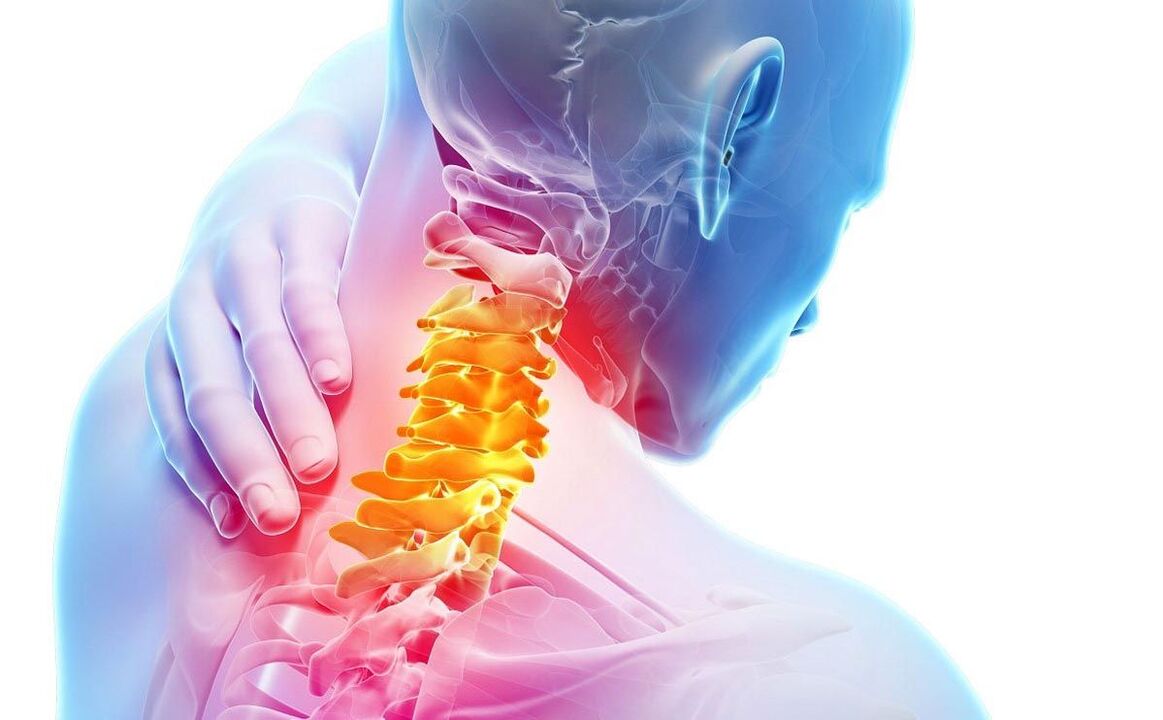 Pain caused by cervical osteochondrosis