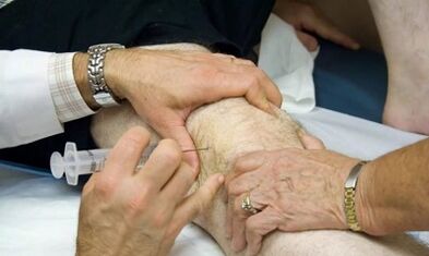 How to distinguish arthritis from arthritis