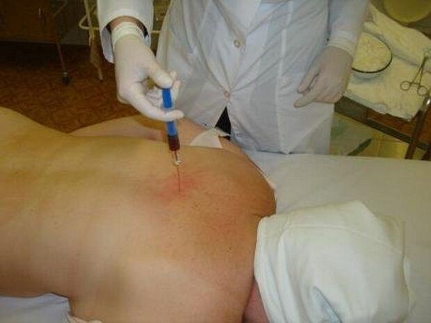 Preparation for osteochondrosis